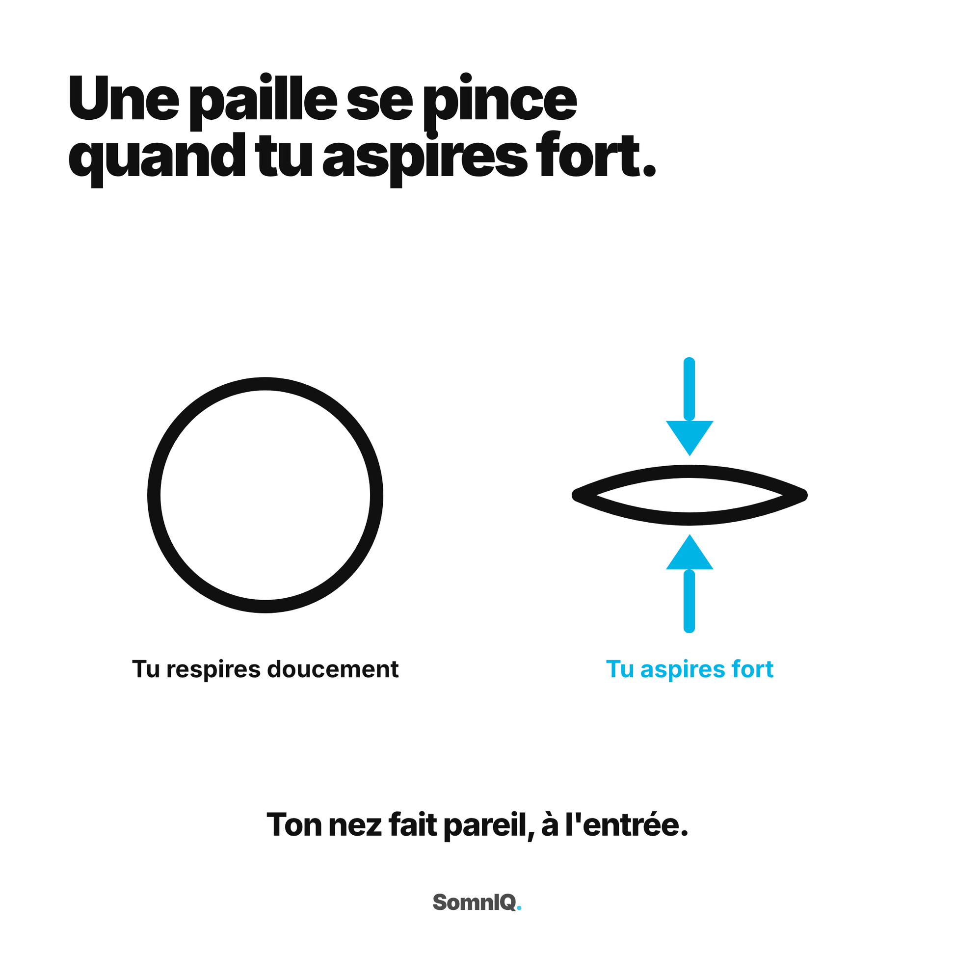La valve nasale externe illustrée par une paille souple qui se pince
