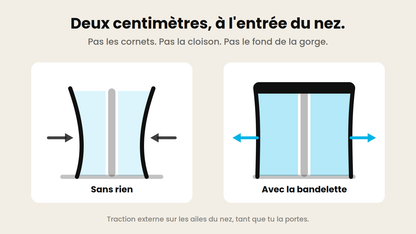 Sans et avec la bandelette : la paroi latérale tenue à l'écart